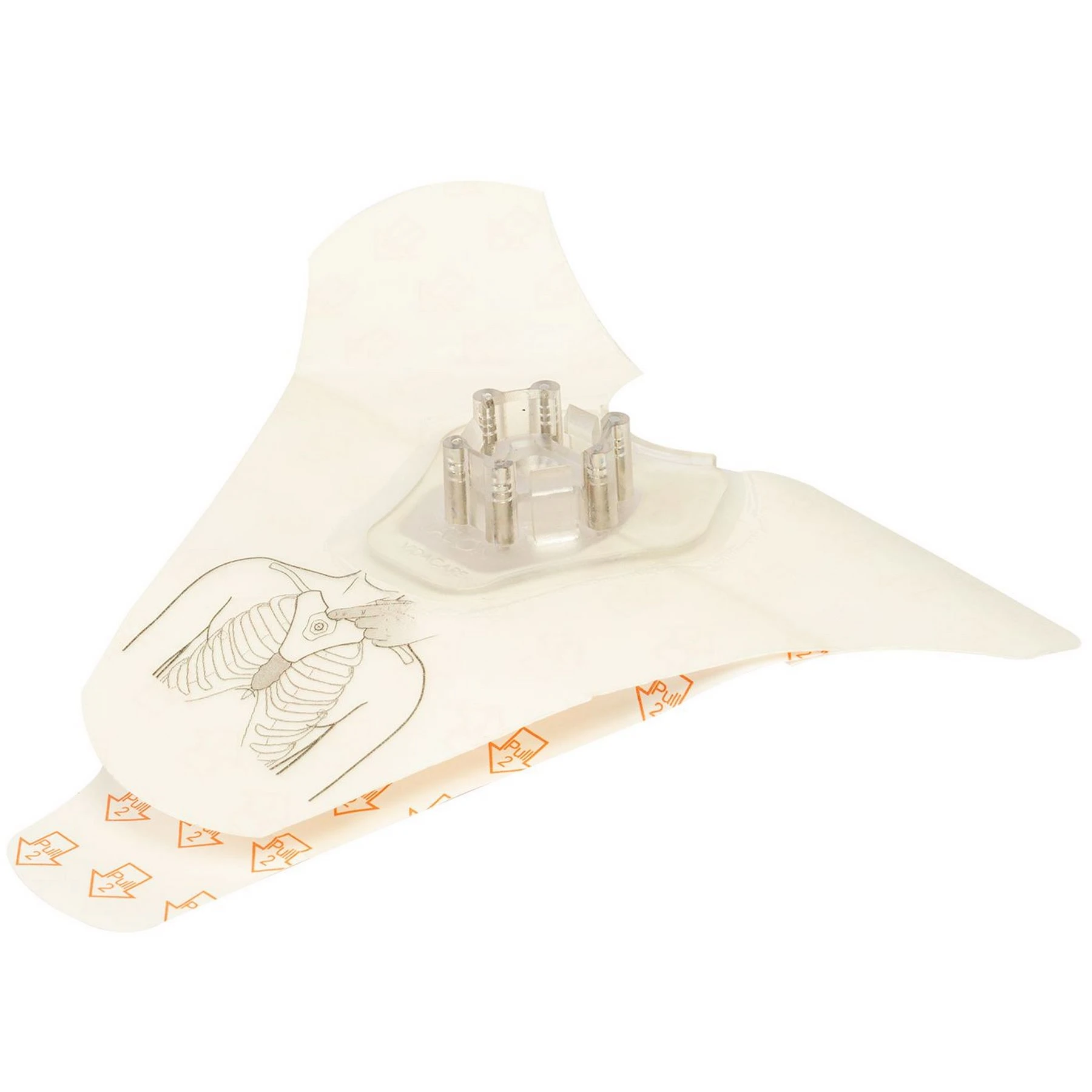 Arrow® EZ-IO® T.A.L.O.N.™ Needle Set / Nadelset | Packung á 1 Stück 6 Arrow® EZ-IO® T.A.L.O.N.™ Needle Set / Nadelset | Packung á 1 Stück – Bild 4